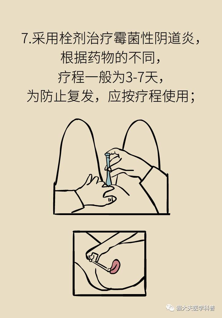 霉菌性阴道炎真的是里面“发霉”了吗？药师教你“抗霉”*法大**