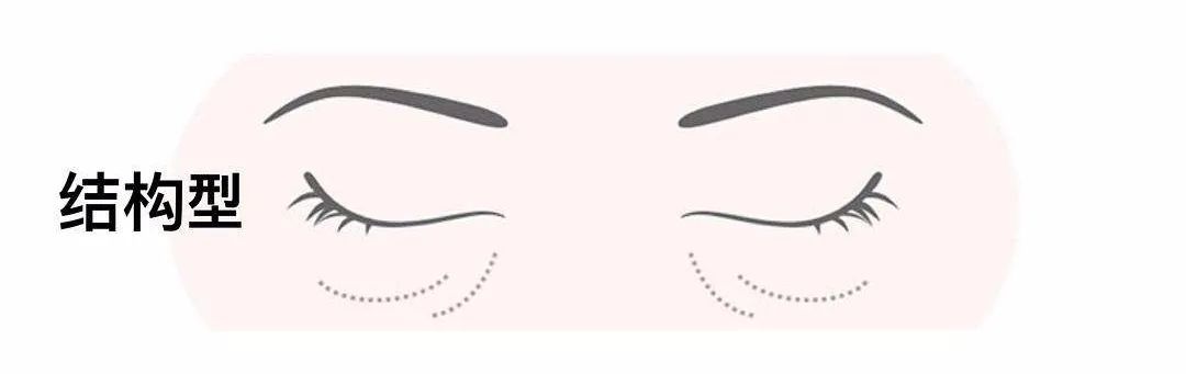 两边黑眼圈程度不一样,黑眼圈的秘密暴露了一个真相