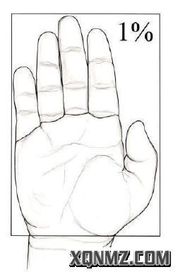 外科烧伤病人的护理教学视频,烧伤患者护理教学查房讲解视频