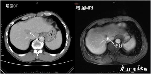 多学科联合诊疗新模式,华西多学科联合会诊
