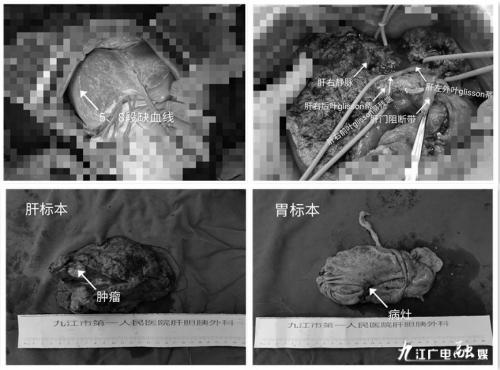 多学科联合诊疗新模式,华西多学科联合会诊