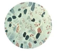 女孩手背溃烂,女孩手部溃烂是什么病