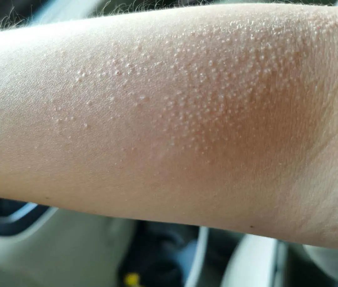 防晒是最重要的事,防晒这点事儿