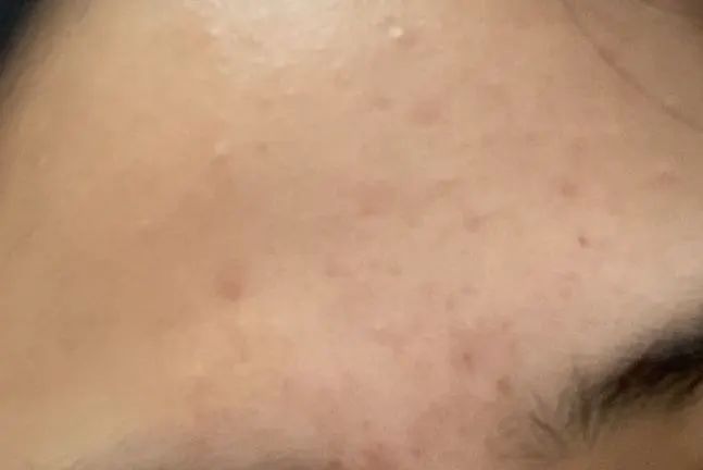 皮肤问题要去专门的皮肤医院吗,各种皮肤问题去哪个医院