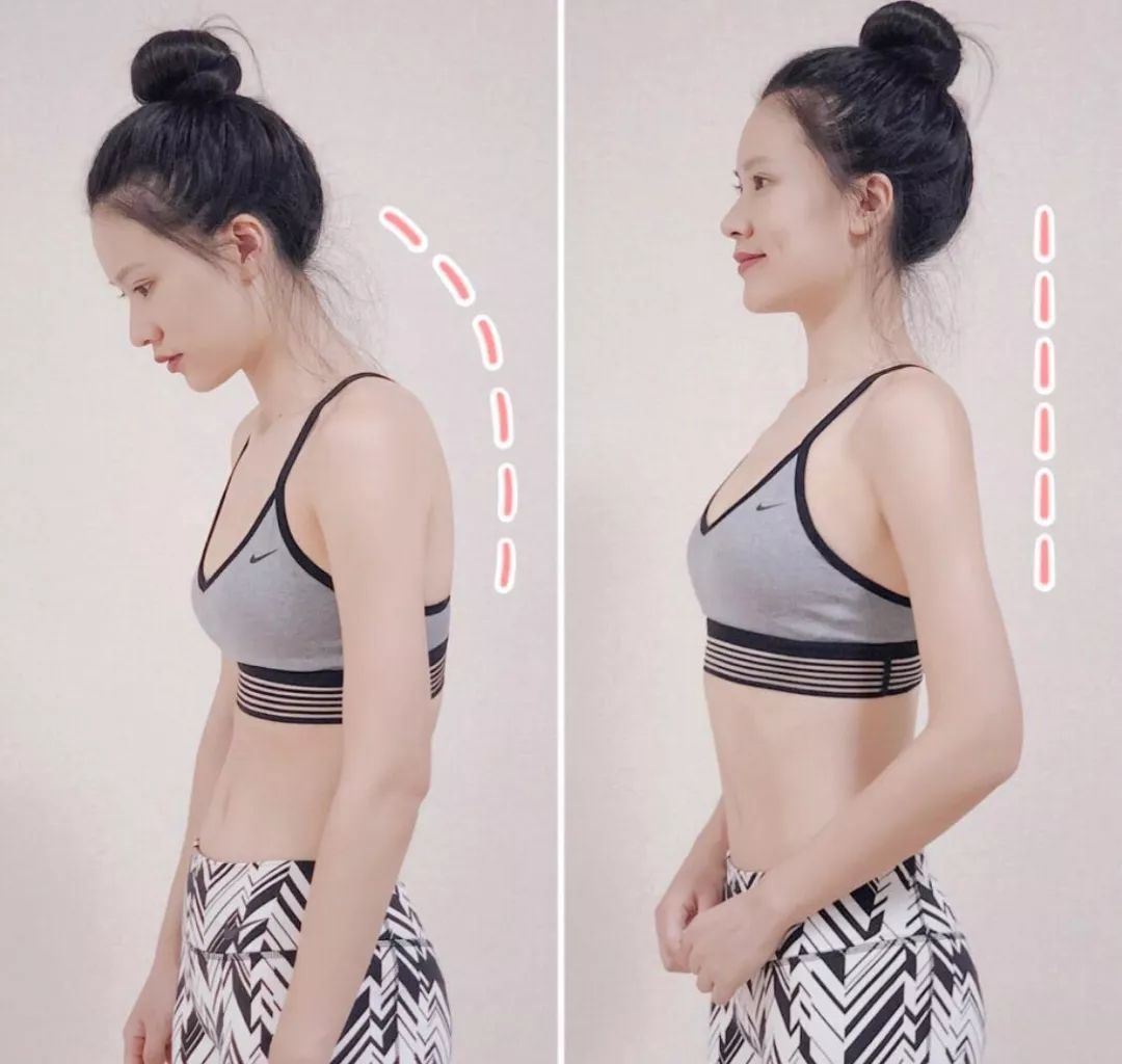 改善含胸驼背的最有效方法10分钟,改善含胸驼背的最有效方法完整版