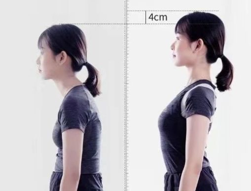 含胸驼背最损气质手把手教你纠正,含胸驼背如何改善提升气质