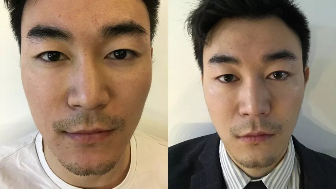 9个最简单有效的美白方法,6个最有效的美白方式你造吗