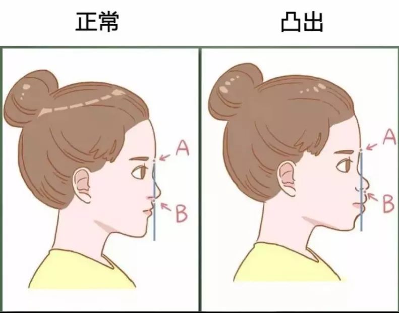 儿科专家小孩睡觉打呼噜,儿科专家小孩睡觉打呼噜在第几集