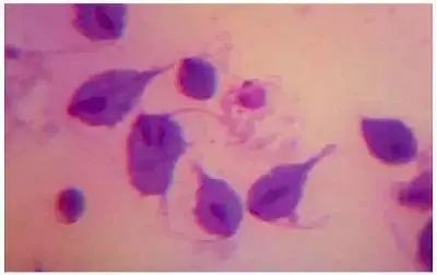 尿道感染虫子,尿道有虫吃什么药好