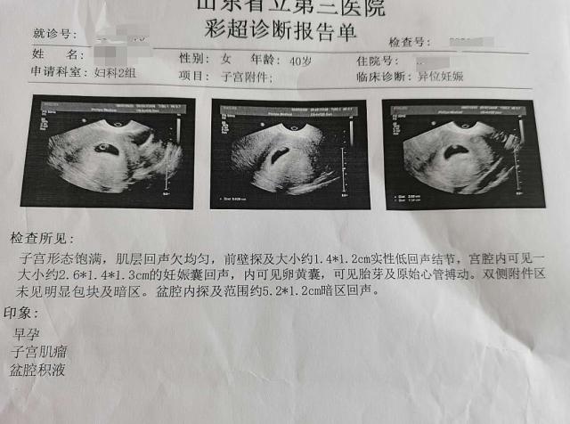 罕见病女子怀孕,罕见女子2个子宫同时怀孕