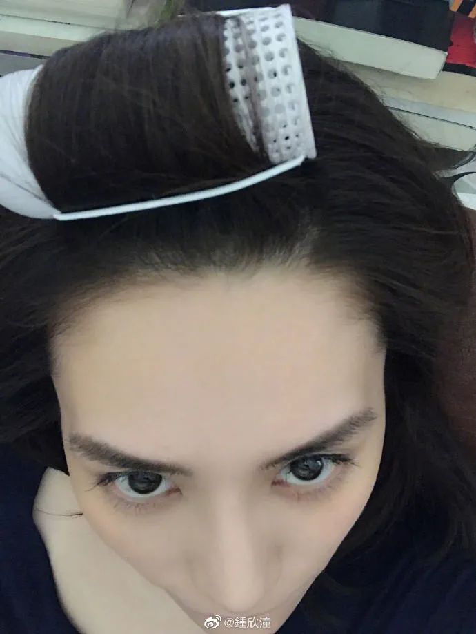 阿娇跌倒受伤,阿娇撞到额头