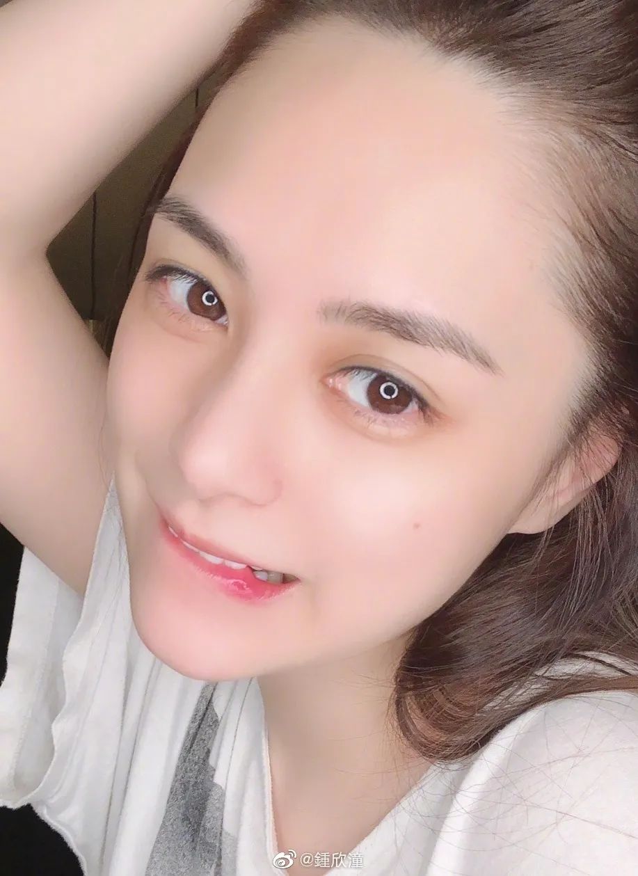 阿娇跌倒受伤,阿娇撞到额头