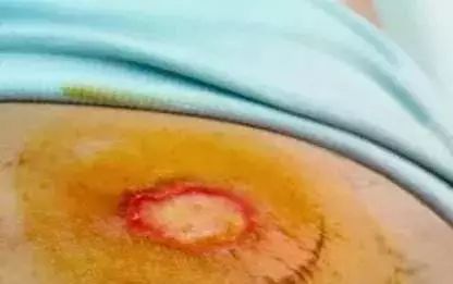 浑身酸疼无力的经方,治疗身体疲惫的中药方法