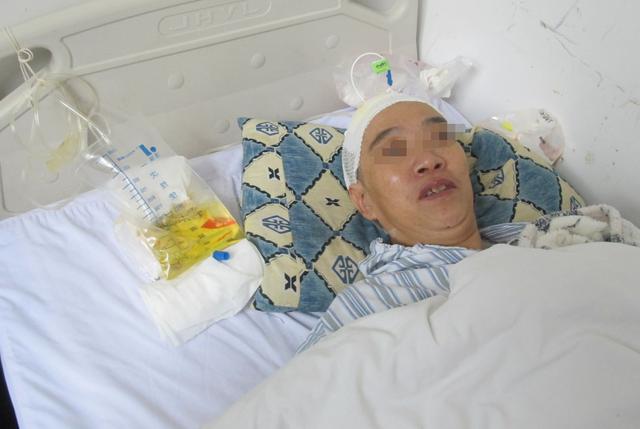 脑积水腹腔分流术后头晕头痛,脑积水分流术后发烧会有什么后果