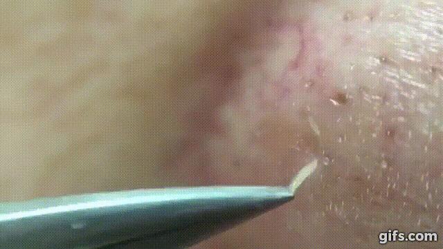 团|墙上插上它，24小时物理除螨，让千万螨虫集体自杀，比太阳暴晒强10000倍