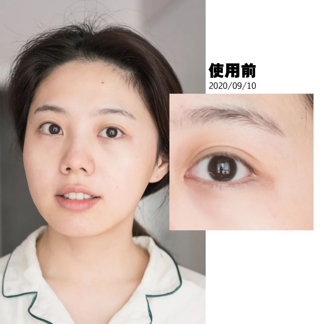 真实有用的几款美容仪,坚持用5年的美容仪