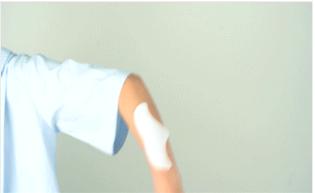 抬头纹眉间纹怎么去除,眉间纹抬头纹去除最好的方法