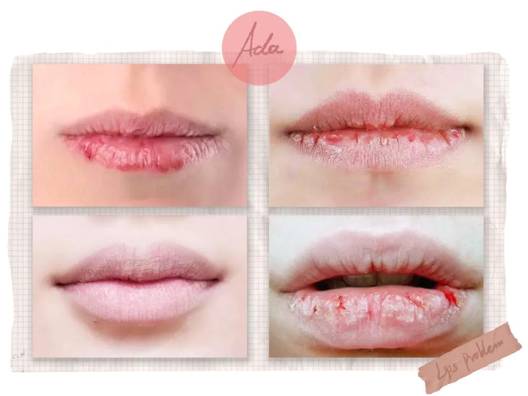 不合格的润唇膏致癌,唇膏选不对有致癌风险