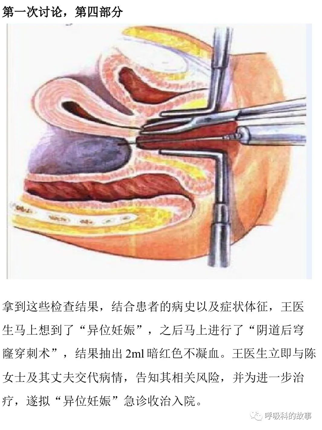 不一样的“月经”，不一样的PBL课