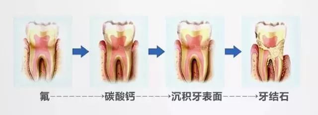 烟黄牙齿用什么牙膏牙齿能变白,黄牙烟渍牙有救了