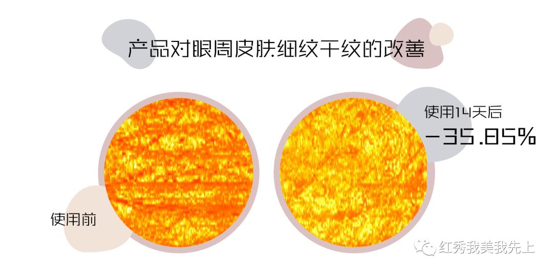 眼霜15天实测,14天实测女巫眼霜