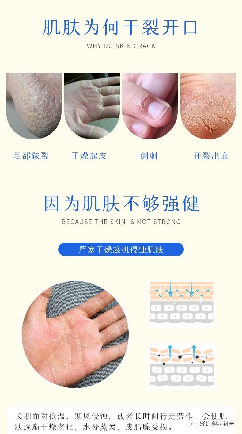 军医生裂可宁多少钱一盒,19.9元2瓶皲裂膏