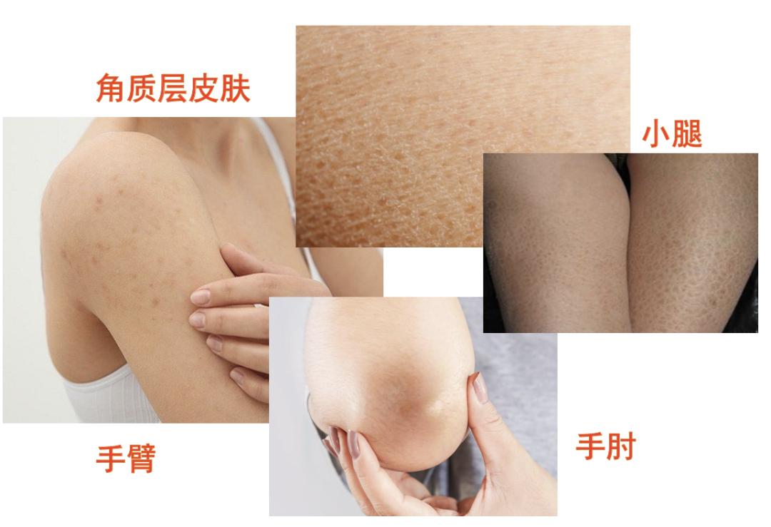 还在用洗面奶让你的脸越洗越白,还在用的洗面奶