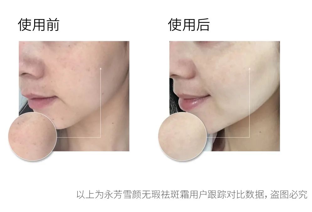 推荐一下你们用过的最好的祛斑霜,公认十大最好的祛斑霜