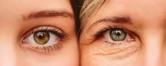 欧阳娜娜关晓彤眼霜,欧阳娜娜眼霜去黑眼圈