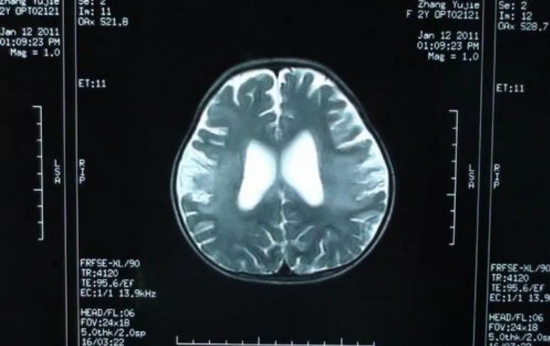 百度“如流”，我劝你从善如流