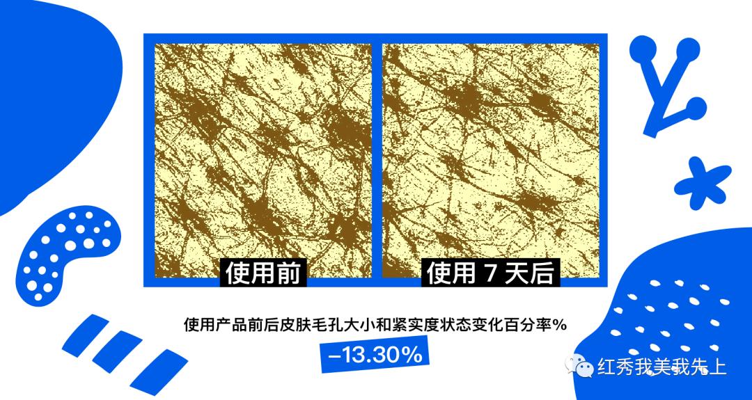 靠精华可以提升紧致吗,精华水可以收缩毛孔吗
