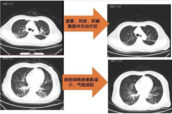 咸阳市第一人民医院风湿血液科,风湿骨病妙手医生