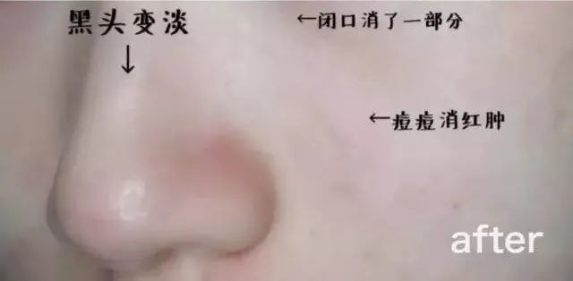 300多元抢大牌:排队也难买的CPB长管隔离!手慢无