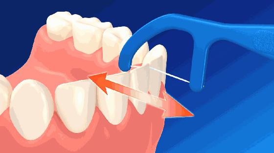 小孩牙齿护理可以做哪些项目,牙齿护理的正确方法和步骤