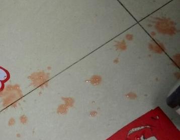 经常咳嗽白色的泡沫粘液,咳嗽痰多白色泡沫痰粉红色