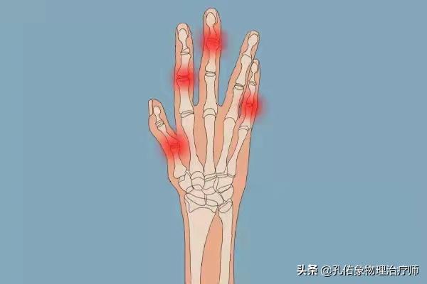手指肿胀有硬硬的感觉,手指有结节有僵硬疼痛是什么病