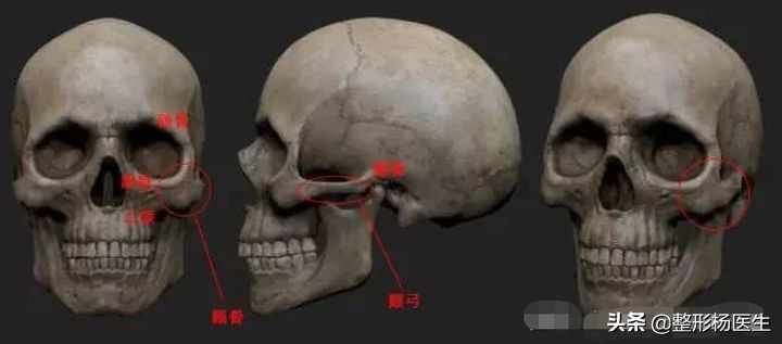 改变脸型除了削骨还有其他办法吗,国字脸磨骨成瓜子脸