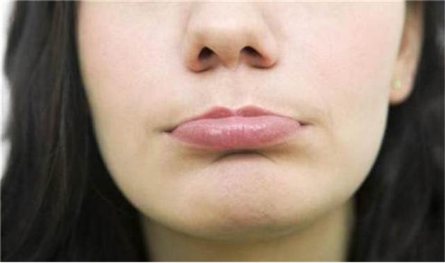 导致嘴唇厚的坏习惯,如何防止唇部越来越厚
