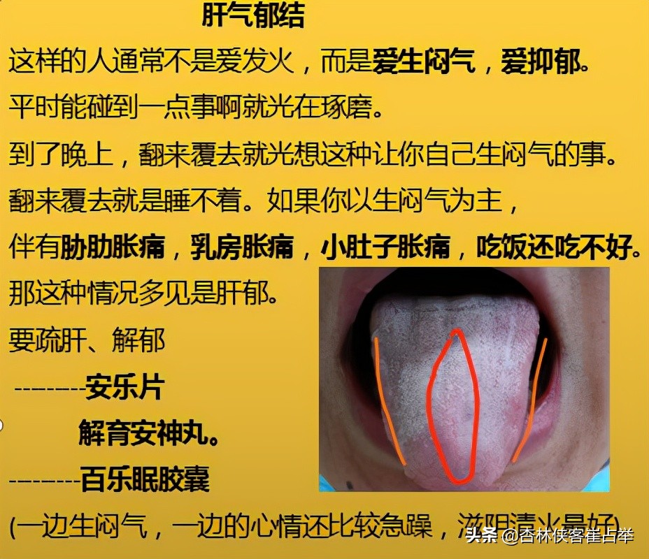 治疗失眠什么中成药效果好,治疗失眠中成药大总结