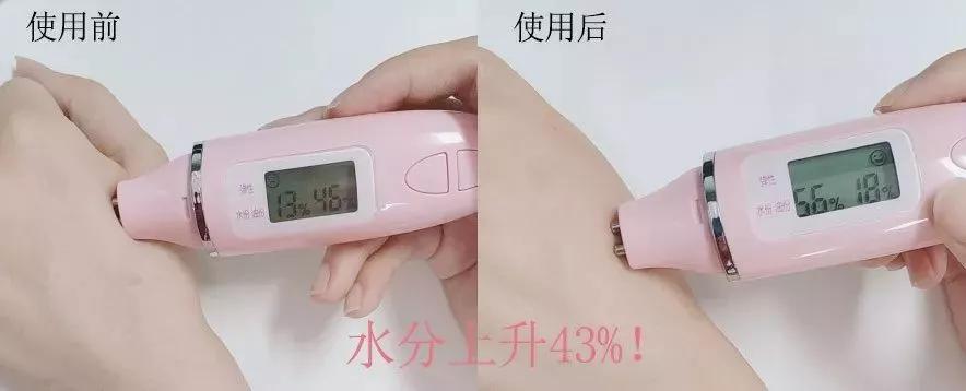 祛痘淡斑美白神器,2毛钱淡斑