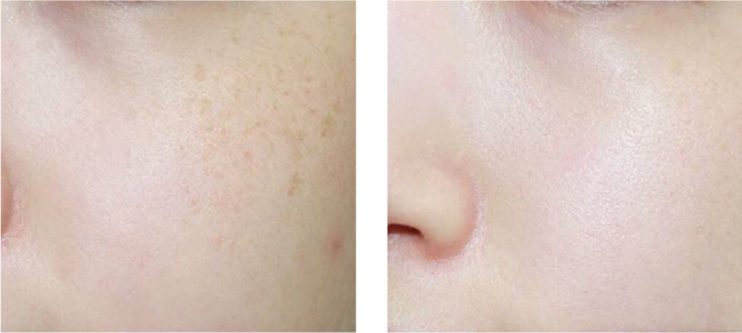 一款不输医用面膜的修护补水面膜,不输大牌的淡斑美白面膜