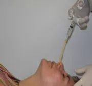 肺炎为什么要查b超,为什么现在肺炎就做ct