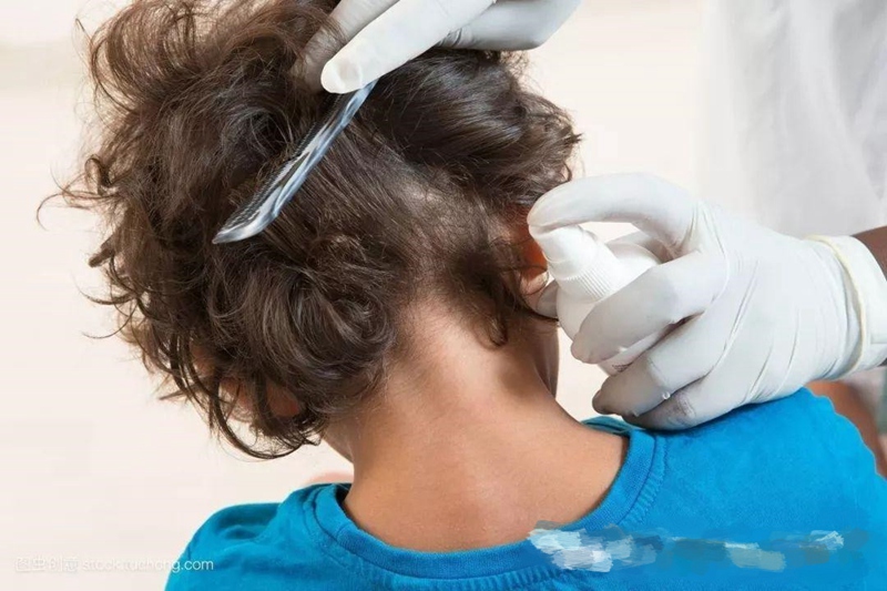 女儿头上长虱子妈妈给剃光了,女童冬天头上有虱子怎么办