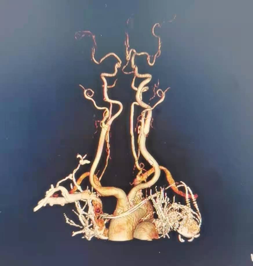 中医疏肝能治疗焦虑抑郁症吗,抑郁症疏肝理气操