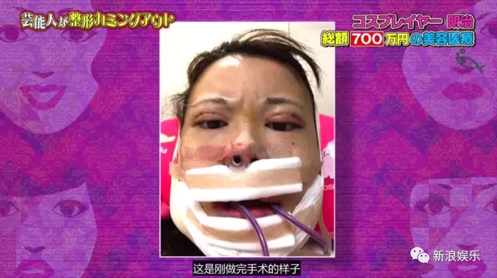 那些整容脸真的觉得自己好看吗,为什么整容以后都是一样的网红脸