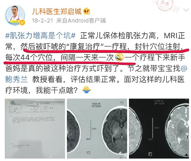 郑州三附院治疗脑瘫怎么样,河南中医治疗脑瘫孩子的大夫是谁