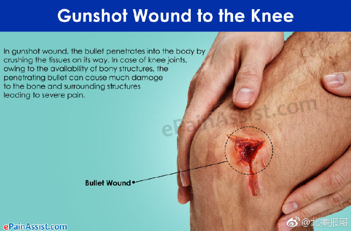 人体一旦被子弹击中后会怎样,被麻醉弹击中会怎样