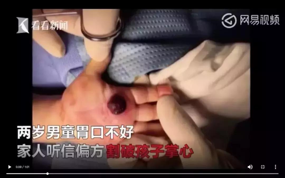 儿科偏方大全100个,中华民间治病偏方大全图