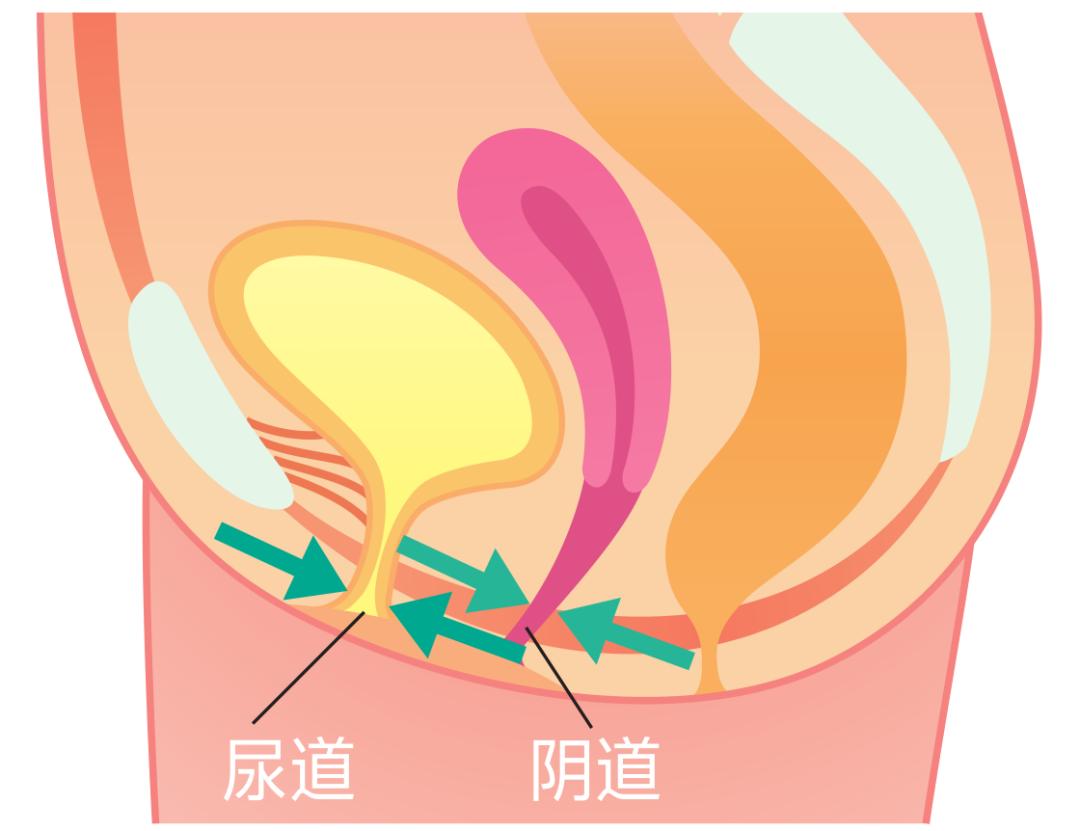 改善盆底肌松弛尿频,改善盆底肌松弛漏尿仪器怎么做