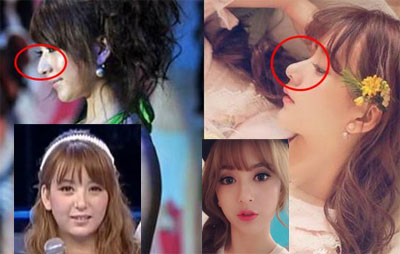 武汉一整形机构*脑洗**女大学生签高息*款贷**，称颜值即未来，外貌焦虑